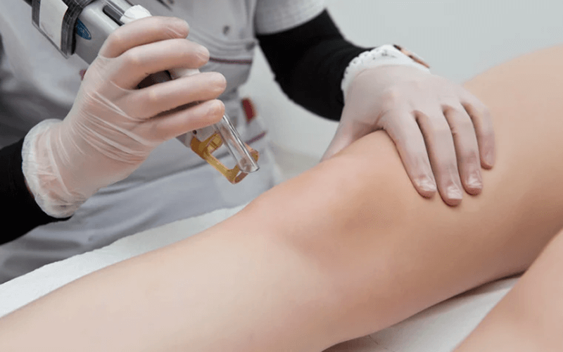 Erchonia cold laser therapy device in clinic